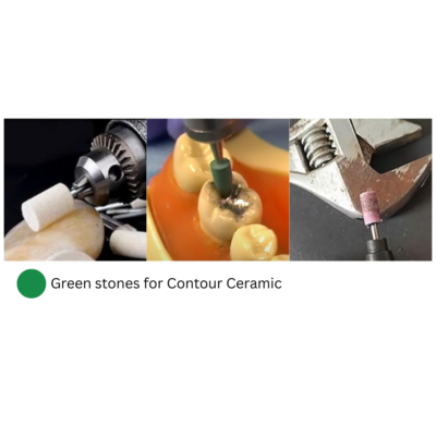 [B&D] Green Stones for Contour Ceramic